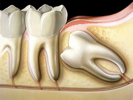 Cirurgia Dentária
