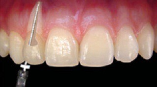 Endodontia