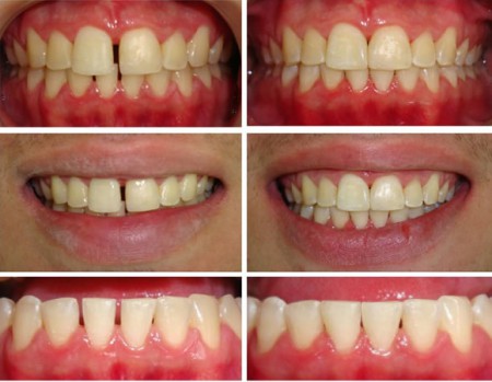 Dentística Restauradora